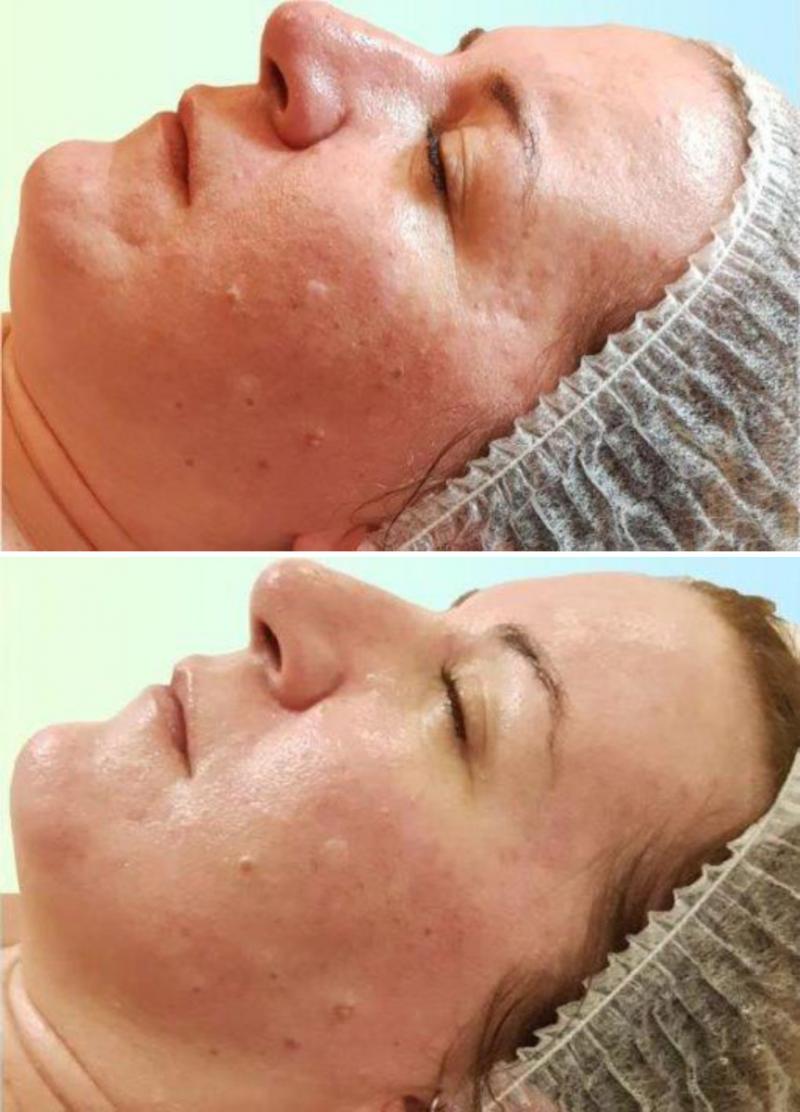 Regenerationsbehandlung Frau